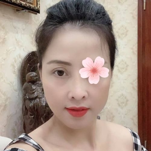 Anh Minh